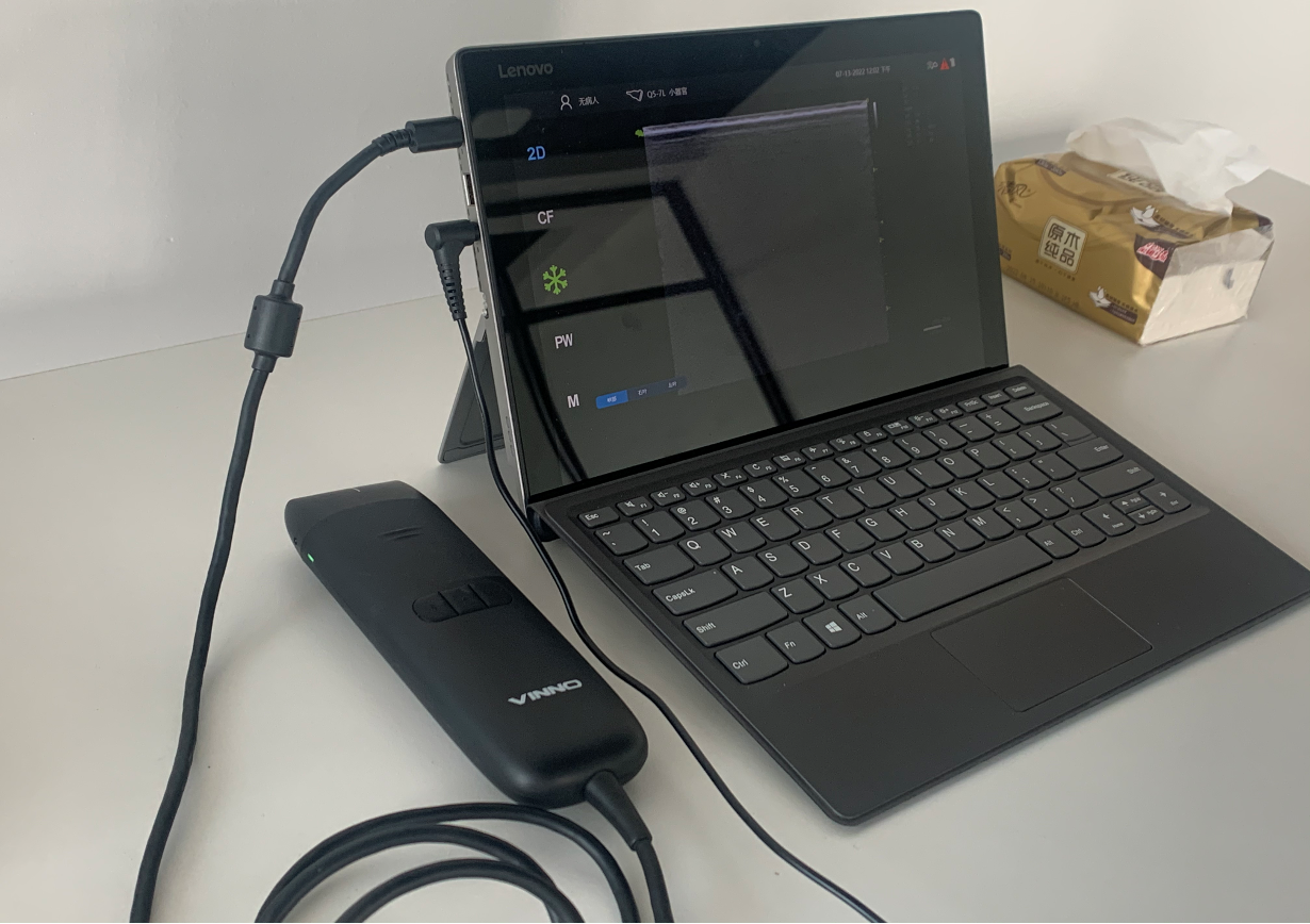 甲状腺超声AI检测